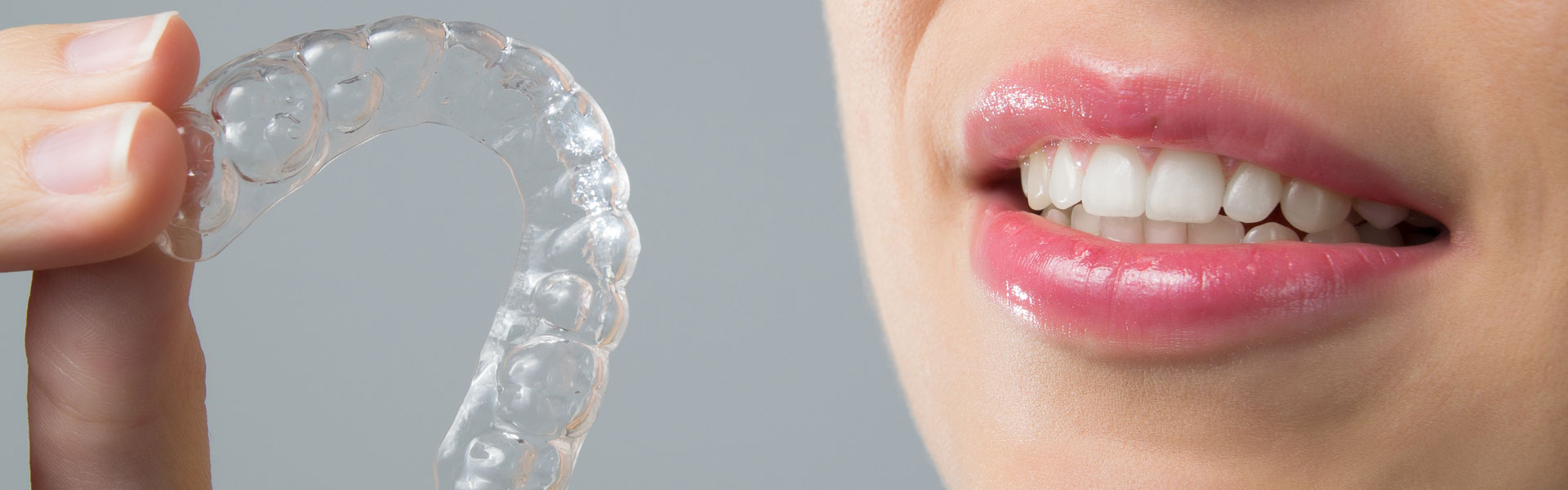 Woman holding an invisalign
